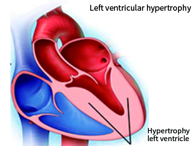 https://www.ebionet.com/wp-content/uploads/2020/10/lab24-ventricles-heart.jpg