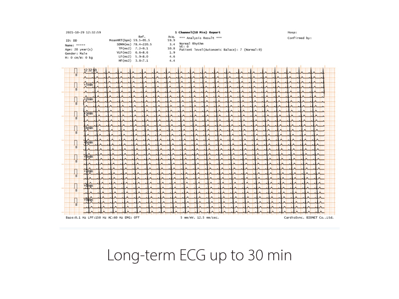 CardioP1 long-term ECG up to 30 min