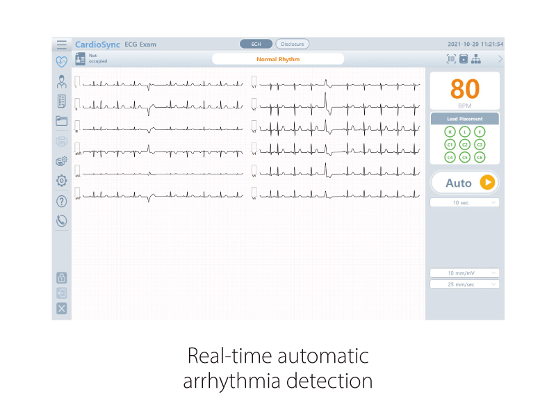 CardioP1 real-time automatic arrhythmia detection