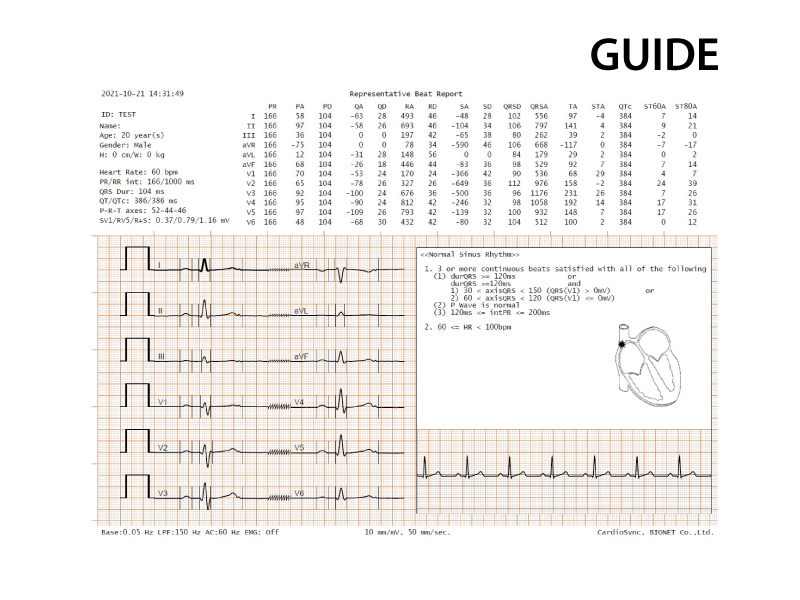 CardioP1 special report guide