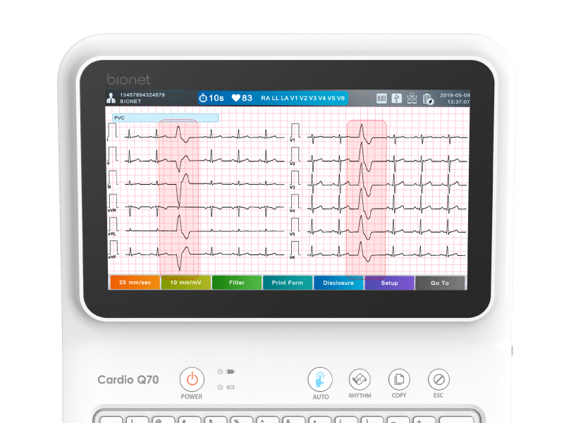 CardioQ70 Real-time arrhythmia detection